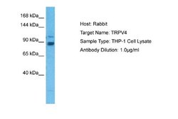 TRPV4 Rabbit anti-Human, Rat, Polyclonal, Novus Biologicals 0.1ml; Unconjugated:Antibodies,